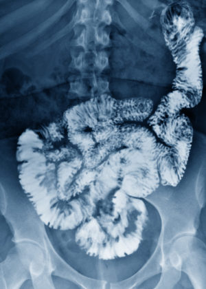 Centre de Radiologie de Poissy - Radiographie numérique Scanner IRM